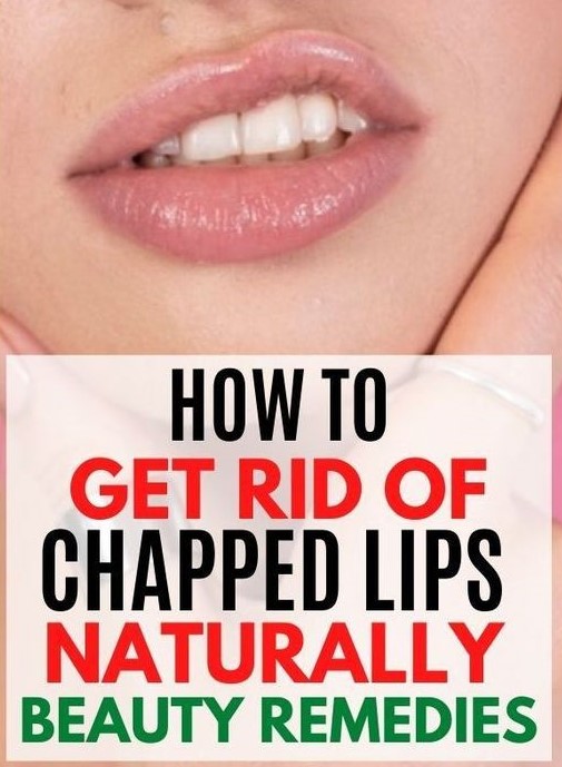 HOW TO GET RID OF CHAPPED LIPS OVERNIGHT