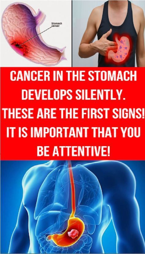 Cancer In The Stomach Develops Silently These Are The First Signs It Is Important That You Be