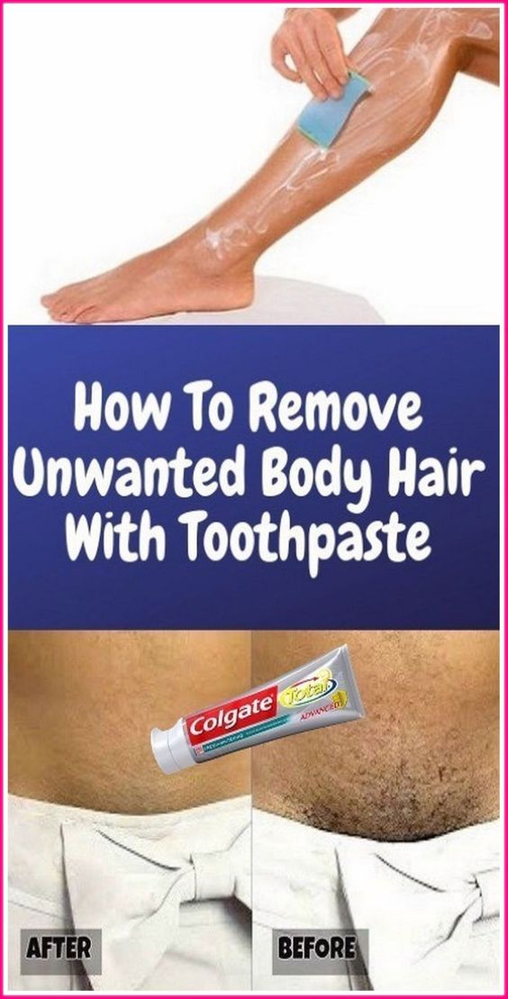 Remove Unwanted Hair Permanently In Three Days No Shave No Wax Removal Facial And Body Hair 