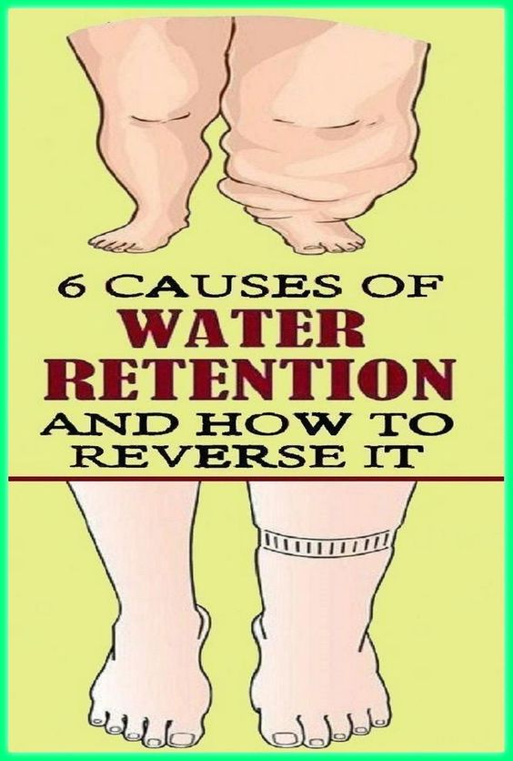 6-causes-of-water-retention-and-how-to-reverse-it-healthy-lifestyle