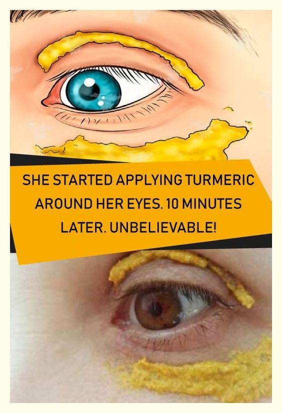 She Started Applying Turmeric Around Her Eyes Minutes Later